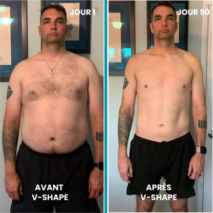 V-Shape 2.0 Nevoshape®