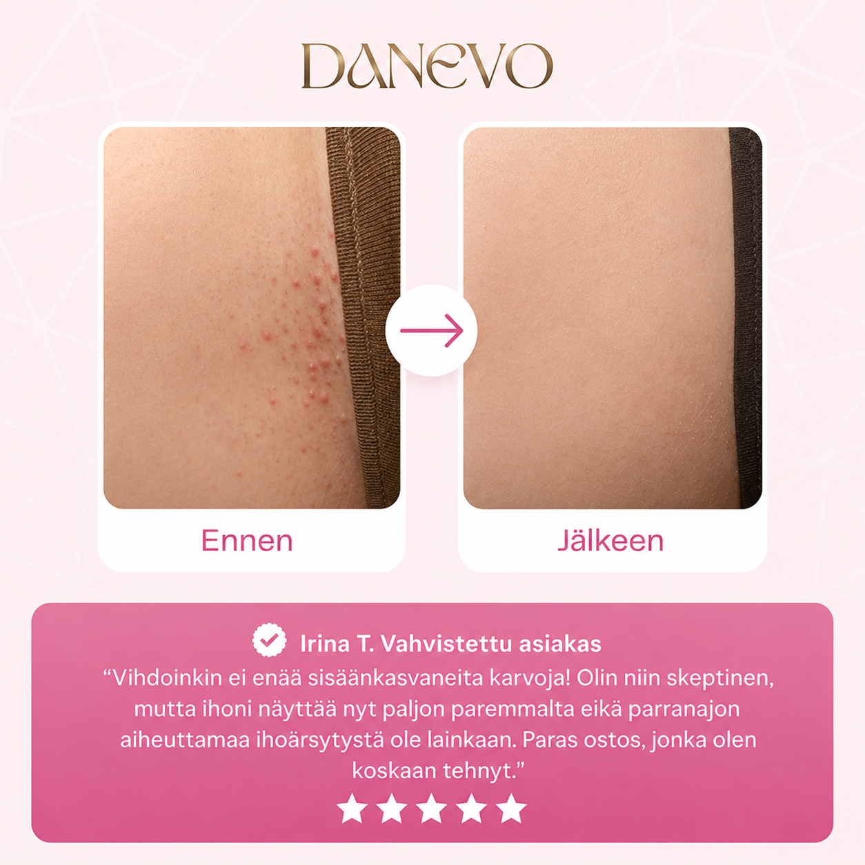 Danevo Dual-Head™ Pro
